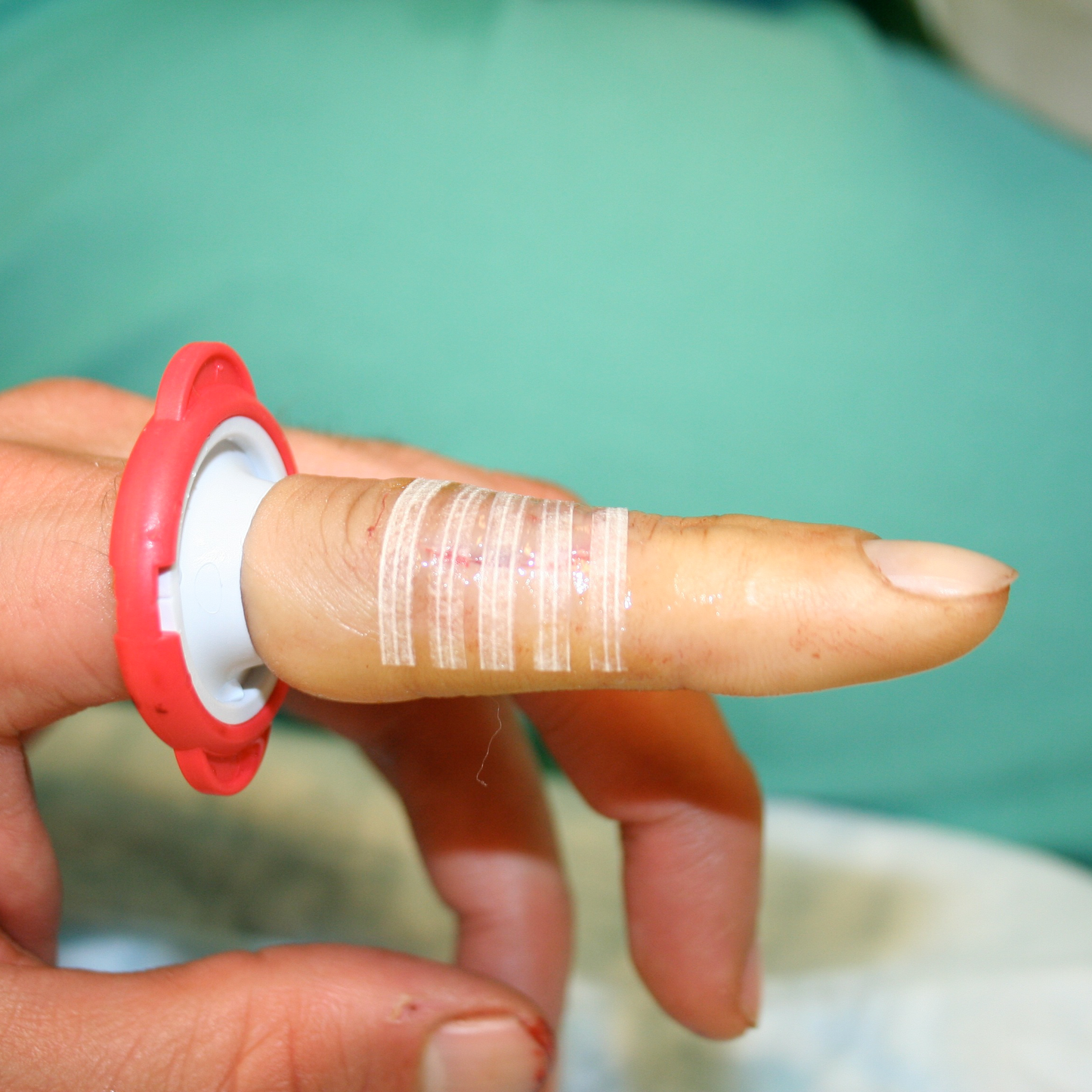 Engångstourniquet T-Ring för Finger eller Tå / 25