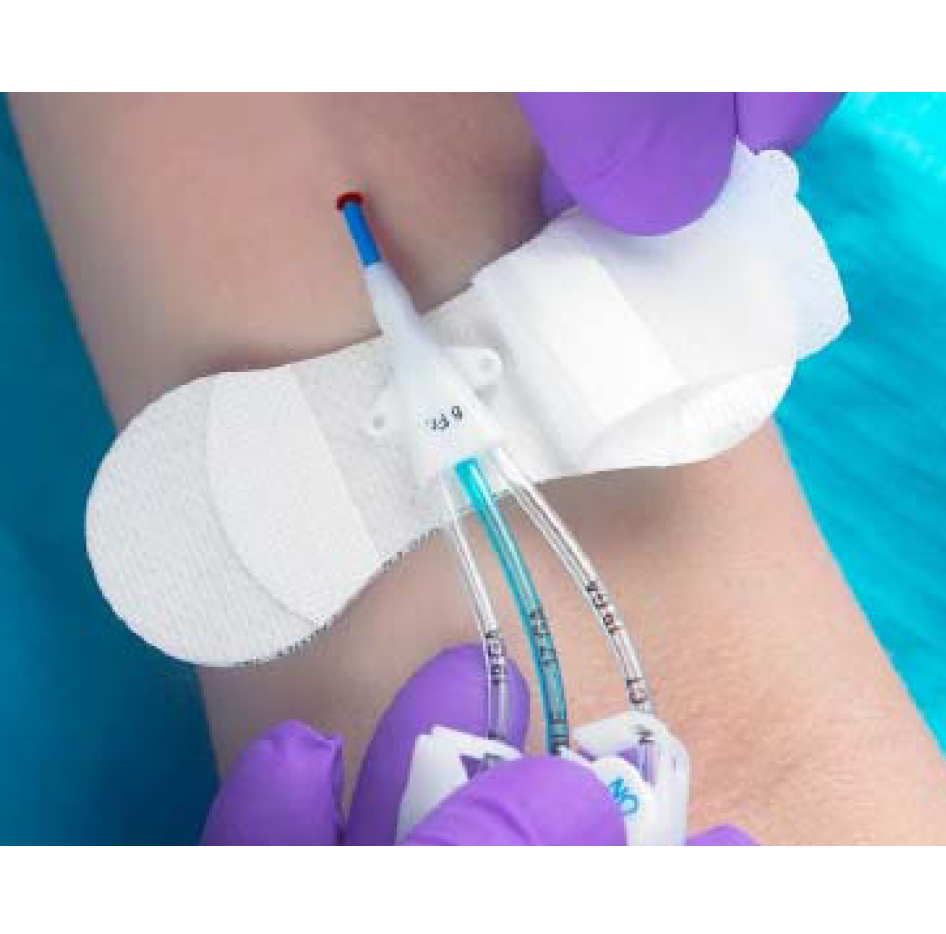 Fixeringsförband Grip-Lok Medium Wide / 100