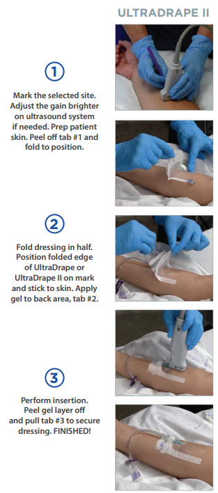 UltraDrape II UGPIV Barrier and Securement 11,9 x 6,7cm / 50