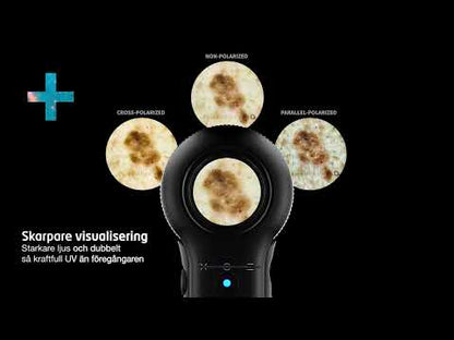 Dermatoskop Dermlite DL5 Plus